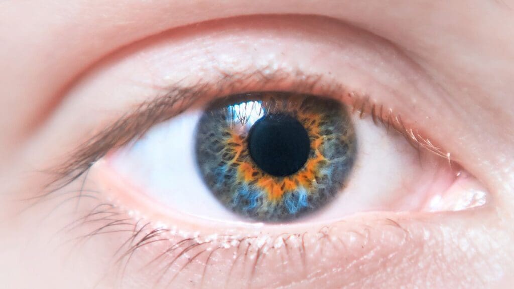 Central Heterochromia: When to Worry About Eye Color