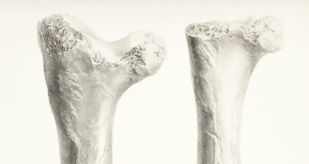 Scientists Find a Switch That Could Stop Osteoporosis, Making Bones Stronger in Old Age