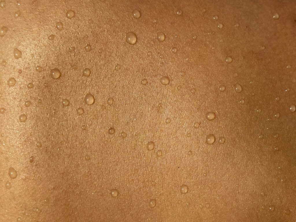 skin barrier