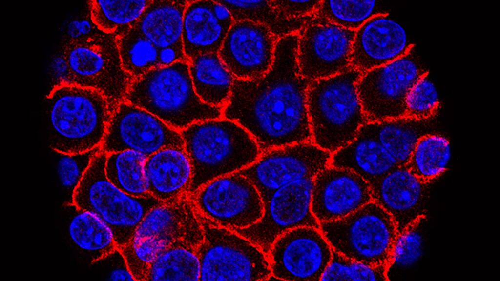 Experimental pill promises new hope for deadly pancreatic cancer Experimental pill promises new hope for deadly pancreatic cancer