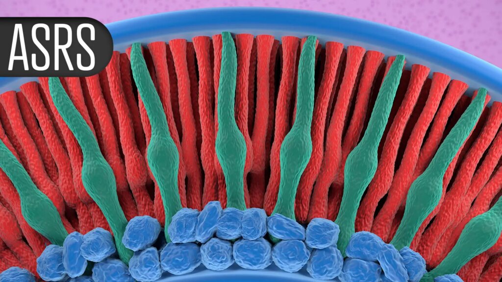 Vision Benefits in GA With Complement Inhibitor, Regardless of AMD, Anti-VEGF Vision Benefits in GA With Complement Inhibitor, Regardless of AMD, Anti-VEGF